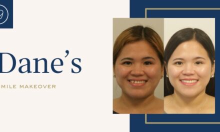 Dane of Marrickville’s Invisalign, Teeth Whitening and Composite Bonding Makeover