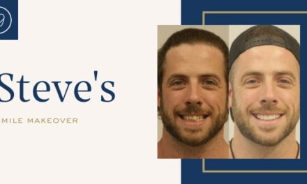 Steve Of Mascot’s Invisalign, Teeth Whitening, Composite Bonding Makeover