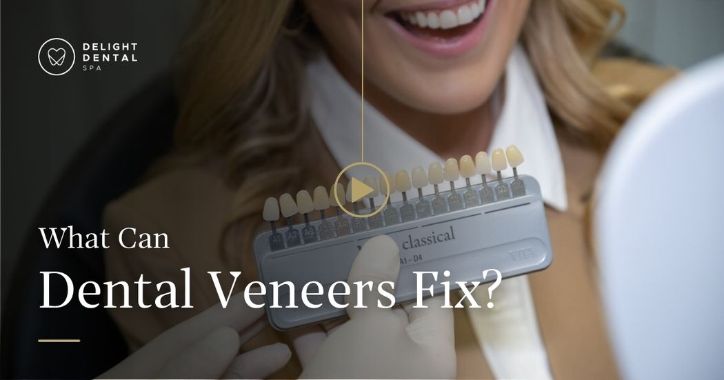 What Can Dental Veneers Fix Near Mascot, Sydney In Delight Dental Spa